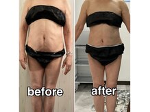 輝 らいとの雰囲気（結果重視◎ウエスト―14cm・体重―4.3kg★12回コース）