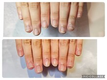 アンドネイル 海老名(&nail)/自爪育成ジェルコース 1回の変化