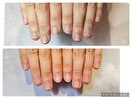 自爪育成ジェルコース 1回の変化