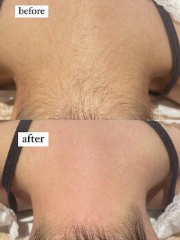 マリブバイメルティ(malibu by melty)/