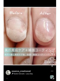 ダメージ爪のお悩み改善にも◎