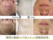 ビズビズ 天王寺店(bisebise)