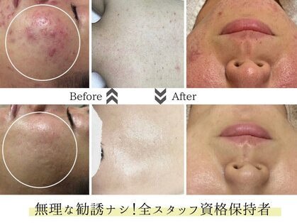 ビズビズ 天王寺店(bisebise)の写真
