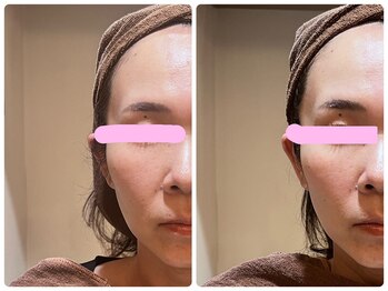 エステティック レイビス 銀座店(RAYVIS)/