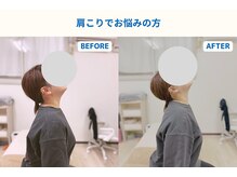 琴似じんぼ整体院/肩こり、整体後の変化