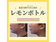 エム(M)の雰囲気（【最先端】半永久の脂肪分解！）