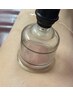 伝統輝くカッピング(吸い玉) 40分　4000円