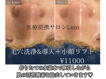 リノ沼津(Lino)