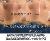 リノ沼津(Lino)