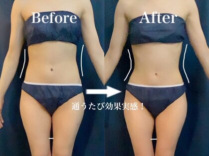 ジョワインフィニ 外苑前(JOIE INFINIE)の写真