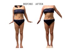 ヨサパーク サノン(YOSA PARK Sanon)/巡りが良くなり腕が上がりやすく