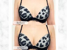 ルルミリ 心斎橋(Lulumili)/ふっくらバストアップ