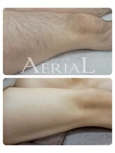 エアリアル 筑紫野店/男女OK！脚脱毛で清潔感アップ