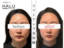 ハル(HALU)