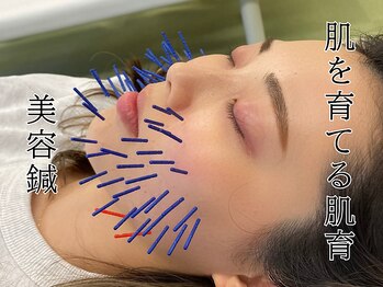 モンダロ(MONDARO)の写真/エステとは一味違う！美容鍼でコラーゲン生成力UP！小顔美肌へ♪