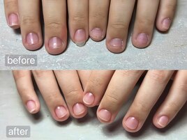 深爪にお悩みの方はこちら