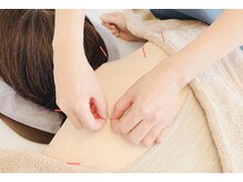 TJMととの鍼灸院の雰囲気（鍼灸が初めての方でもお気軽にご相談ください）