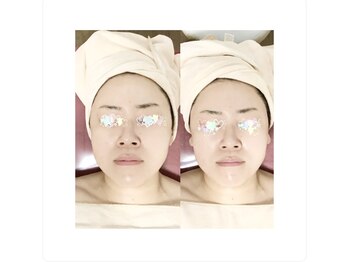 メディカルサロン かとれあ/お客様