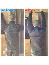 春日部コアラ整体院/Before→After(肩の外転)