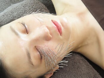 和楽治療院 神楽坂/刺繍美容鍼 