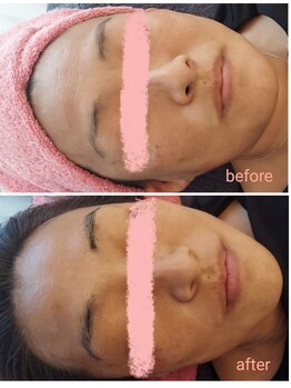 ケイリー(kaylee)/ハーブトリートメント