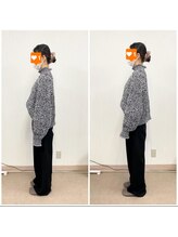 長岡痛み専門整体院みらい 長町店/Before＆After