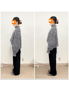 長岡痛み専門整体院みらい 長町店/Before&After