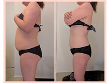 ワイズ(Y's)/お腹16回目