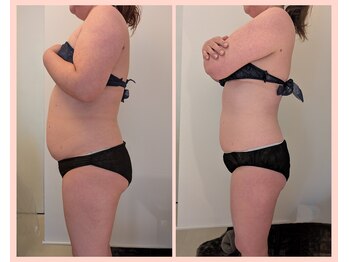 ワイズ(Y's)/お腹16回目