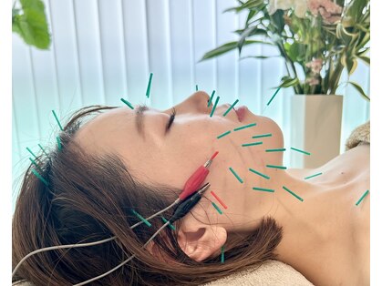 めい鍼灸院の写真