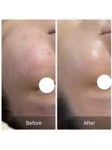 ダリア(Dahlia)/敏感肌や赤ら顔にも効果的