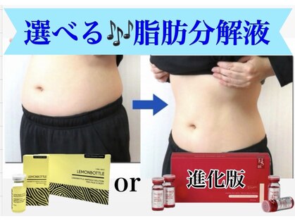 ハッピーエンジェル(Happy Angel)の写真