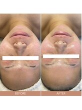 ルルーディア(LOULOUDIA)/透明感のある水光肌へ◎