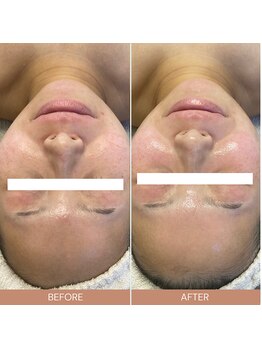 ルルーディア(LOULOUDIA)/透明感のある水光肌へ◎