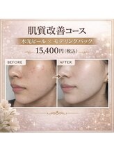ハク(8AK)/肌質改善コース