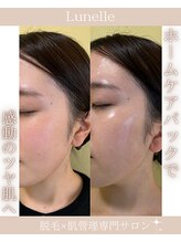 ルネル(Lunelle)/驚きの実感型パック