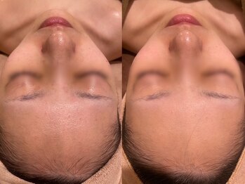 ビュップ 鶴ヶ峰店(美up)/ララピール