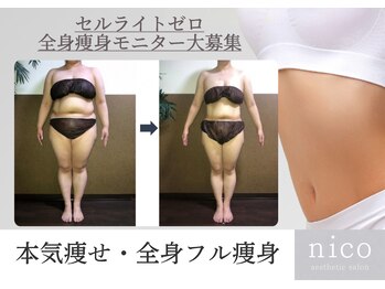 ニコ センター南店(nico)の写真/【セルゼロモニター大募集！】夏に向けて“短期集中ケア/全身フル燃焼痩身”