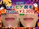 ビビの写真