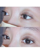 リコリス(Lycoris)/バインドロック圧倒的モチno.1