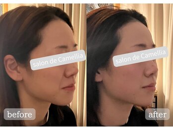 サロンドカメリア(salon de Camellia)/回数を重ねるとしっかり定着も