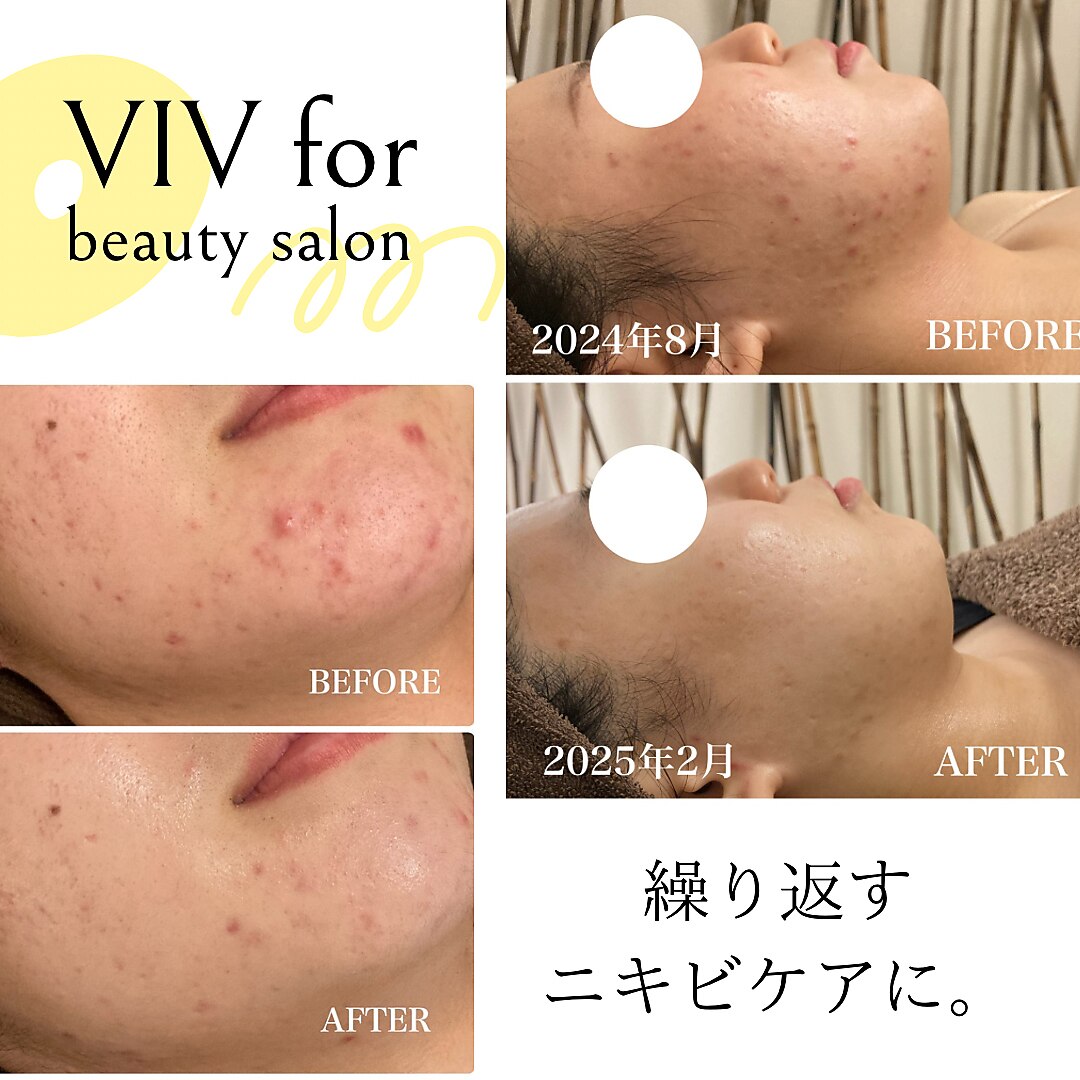 ja　陶肌 陶肌トリートメントについて | Revi