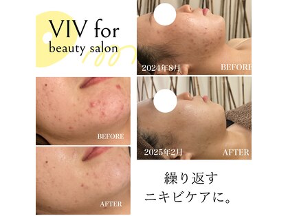 ヴィヴフォー(VIV for)の写真