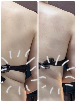 ラグーン(Lagoon)/WINBACK×筋膜リリース