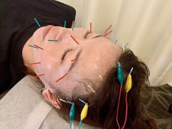 コンフィアンス シンバ(Confiance Simba)の写真/効果の持続がスゴイ！満足度90％以上◎お顔だけでなくトータルでしっかりと整えるからこそ出せる結果◇