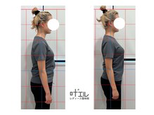 叶'エル 本町 心斎橋院/姿勢改善　全身整体