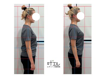 叶'エル 本町 心斎橋院/姿勢改善　全身整体