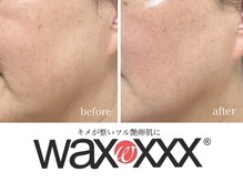 ビュー(Beau)/スキンケアWAX脱毛