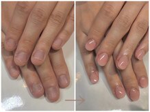 キュアネイル(Qa Nail)/ハンド【深爪矯正】初日変化！