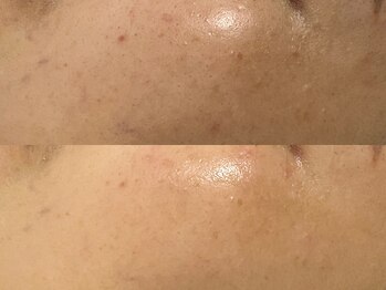 オーガスト(August)/セラピール